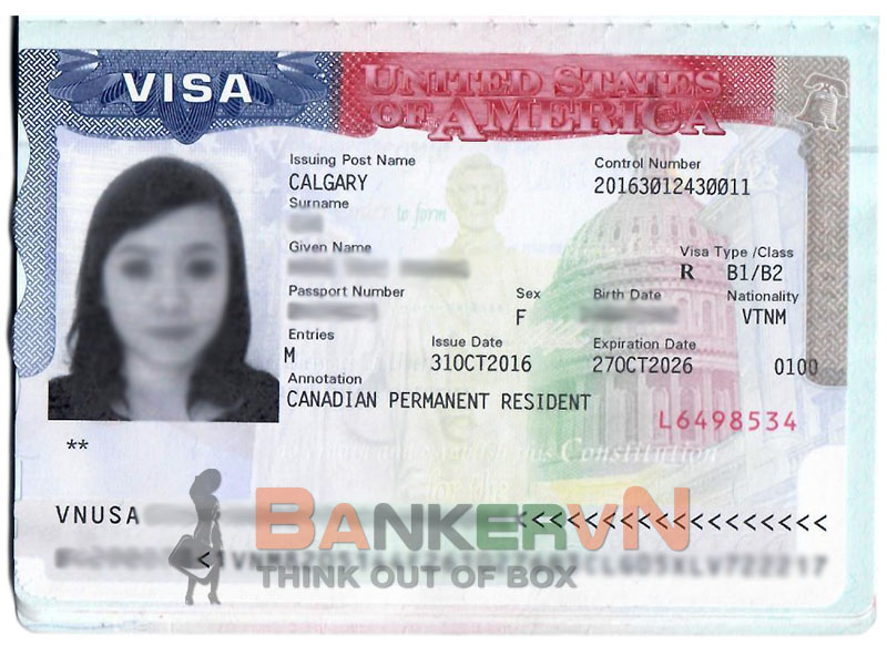 kich co anh lam visa 1